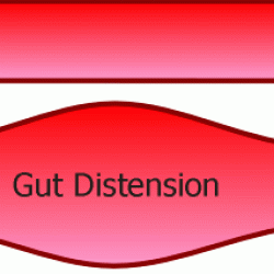 Diagram showing intestinal distension