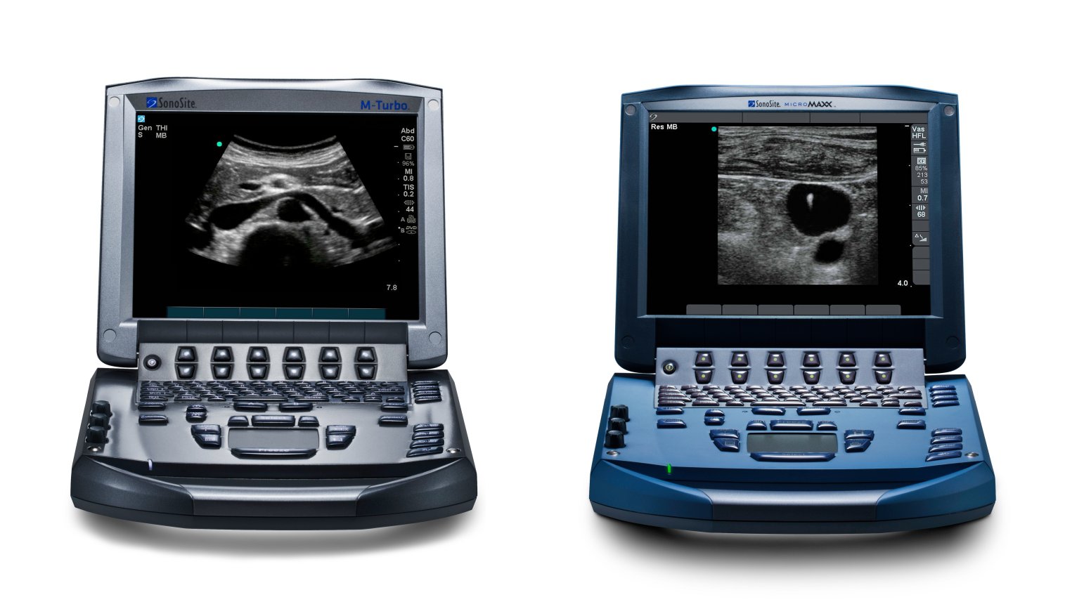 Micromaxx and M-Turbo Ultrasound Machines